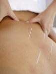 Myotherapy Bayside