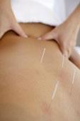 Myotherapy Bayside